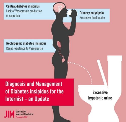 diabetes insipidus